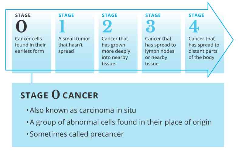 Rak in situ: Kluczowe znaczenie terminu carcinoma in situ - Pracownia ...